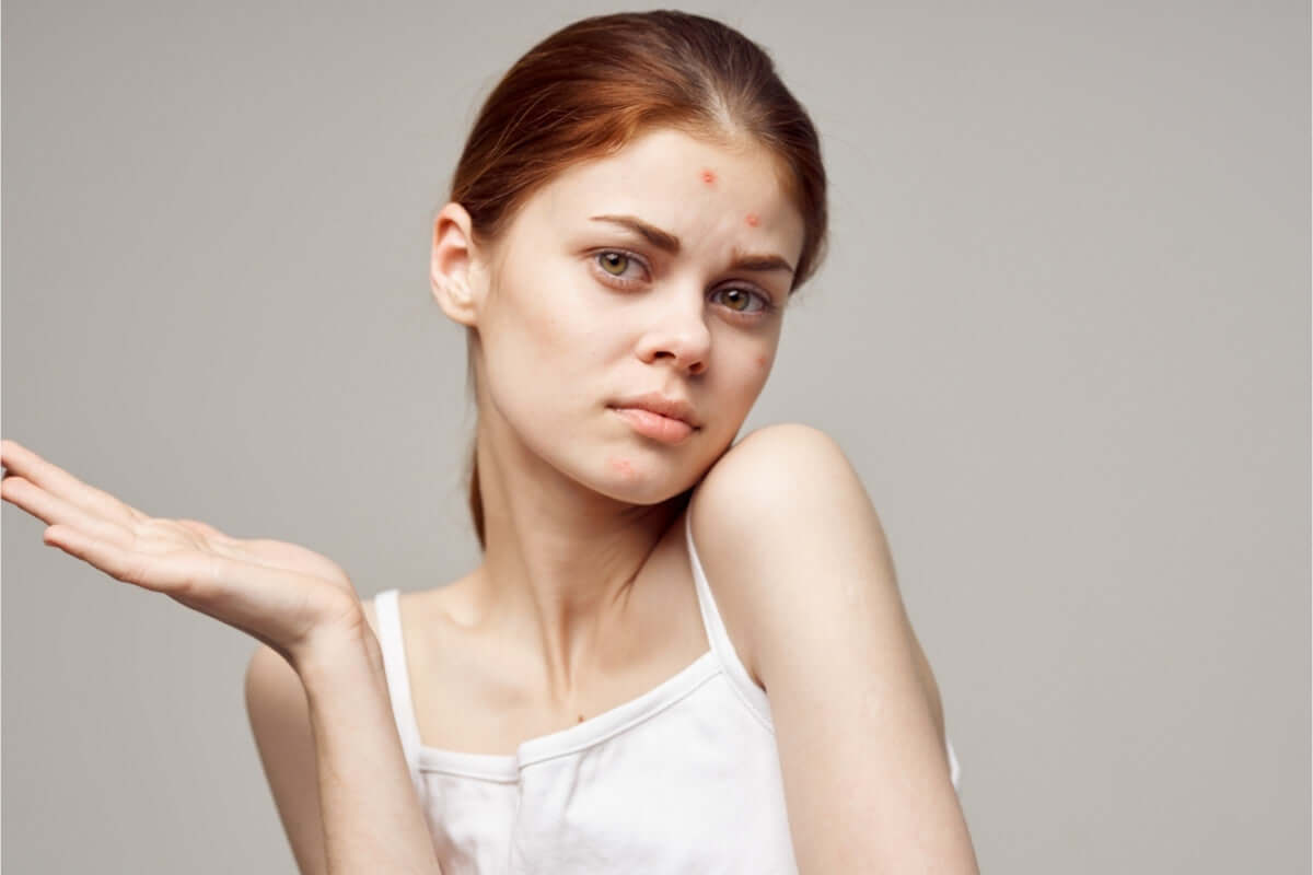 Da mụn nên ăn gì? 5 nhóm thực phẩm giúp hỗ trợ điều trị mụn