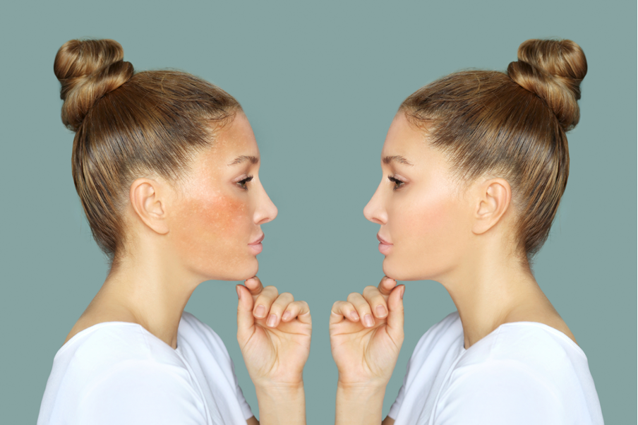 cac buoc skincare cho da xin mau khong deu mau tai nha nhu the nao