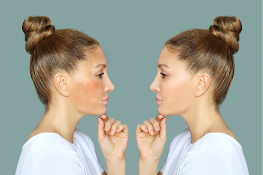 cac buoc skincare cho da xin mau khong deu mau tai nha nhu the nao