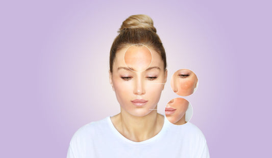 bo duong lam diu da kich ung man do nhay cam dermalogica hieu qua nhu the nao