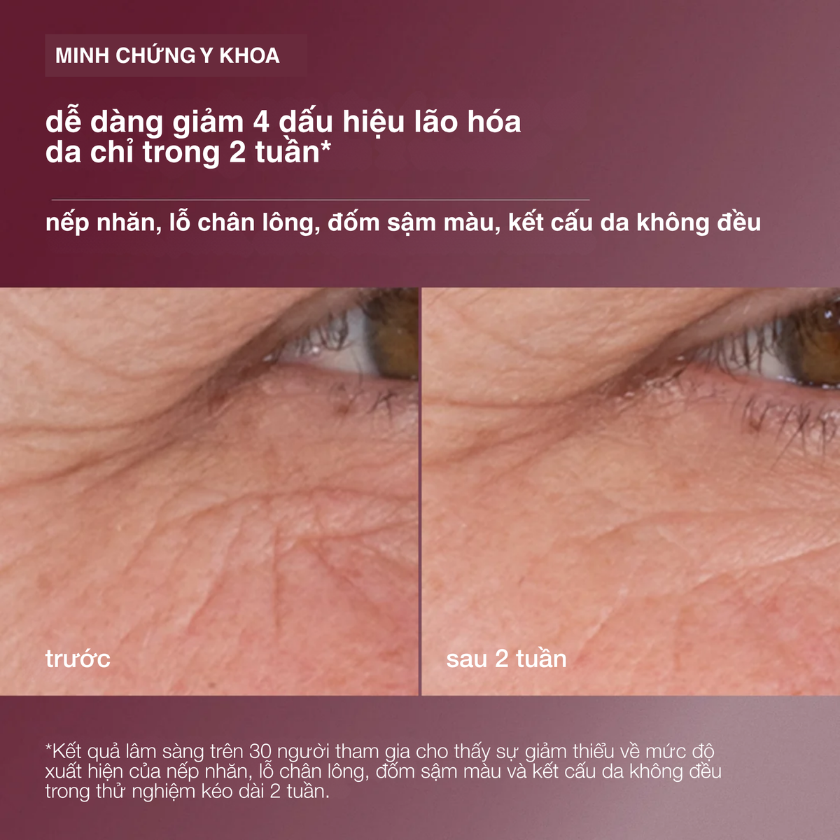 Tinh chất retinol 3.5% Dynamic Skin Retinol Serum