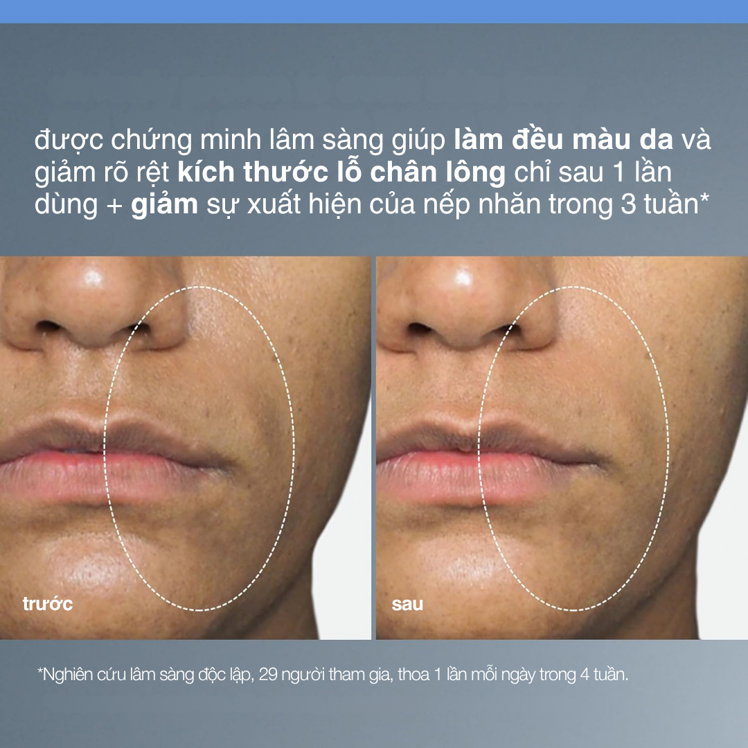 Liquid Peelfoliant 3
