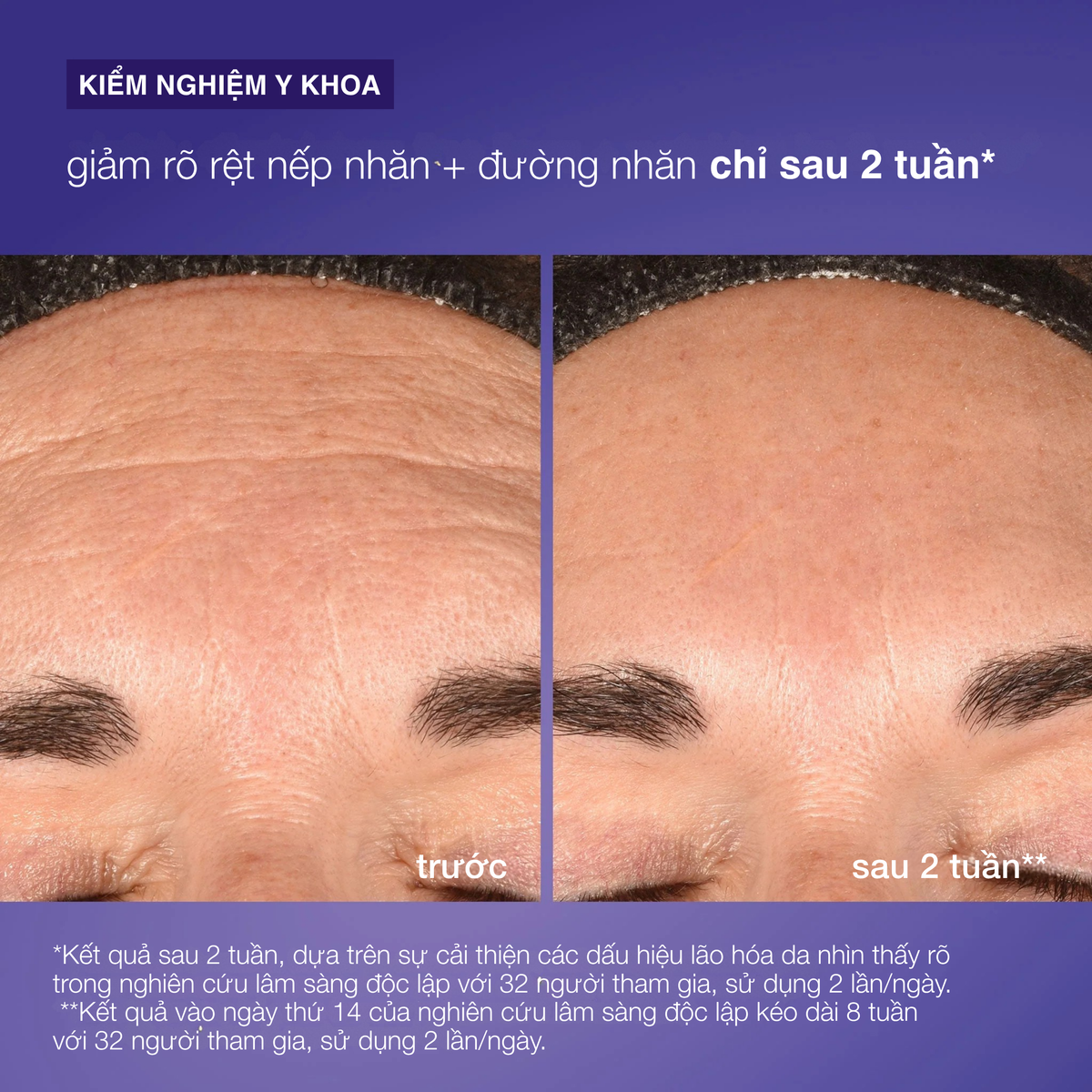 Tái tạo da chứa exosome Phyto Nature E2