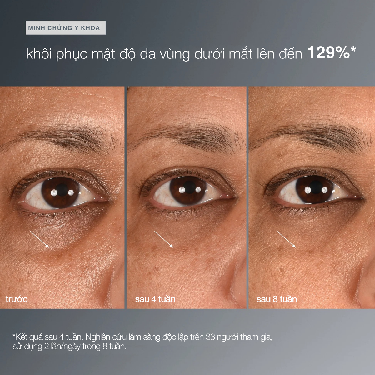 tinh chất vùng da dưới mắt smart eye density