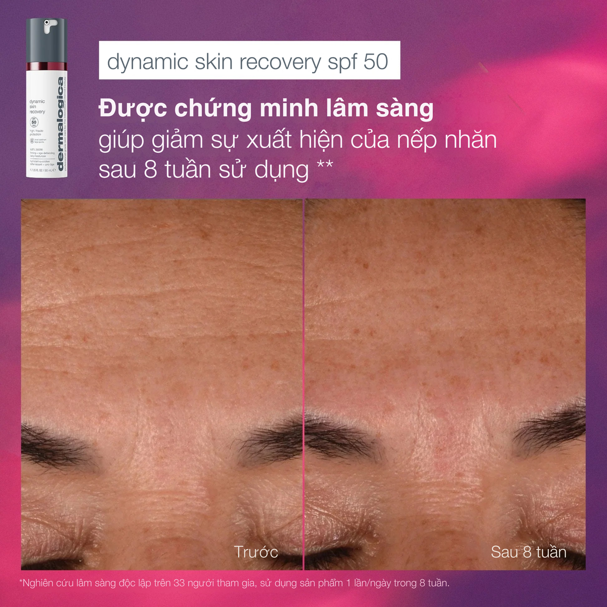 Baỏ vệ + tái tạo chuyên gia
