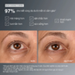 tinh chất vùng da dưới mắt smart eye density
