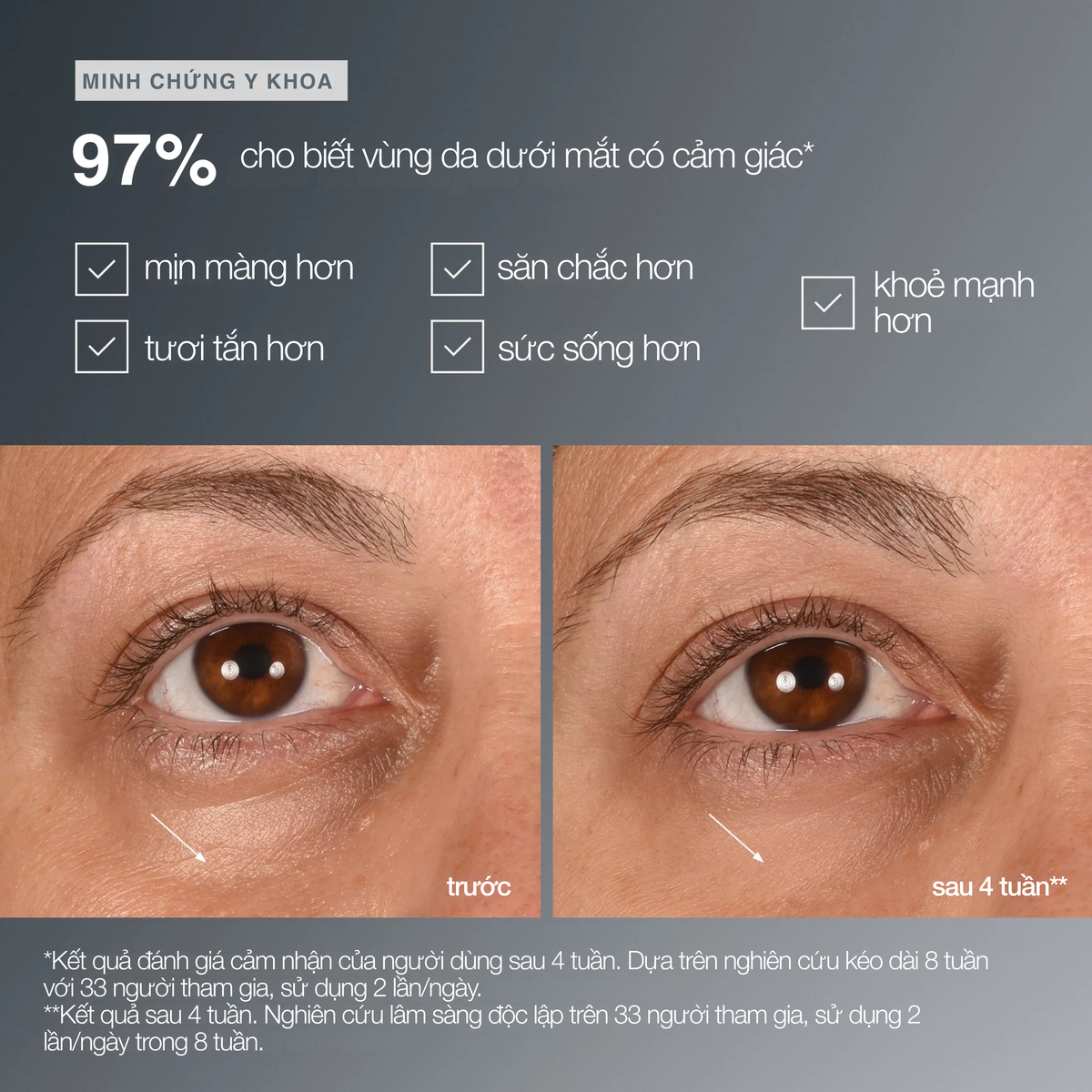 tinh chất vùng da dưới mắt smart eye density