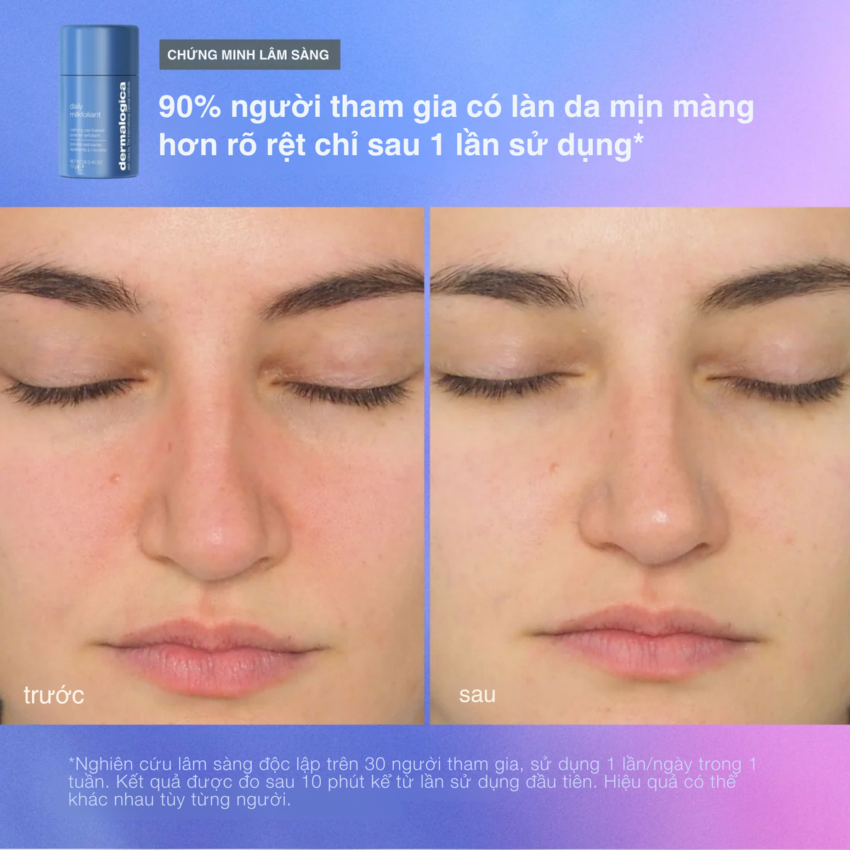 Chuyên gia phục hồi hàng rào (3 travel size)