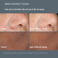 PowerBright Dark Spot Peel 4