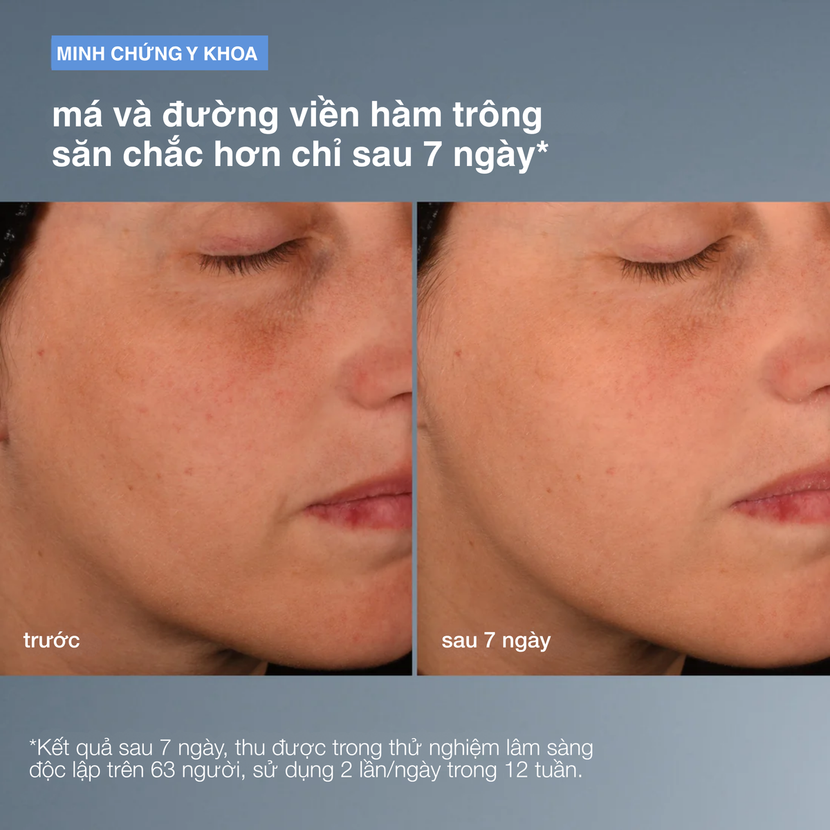 Tinh chất duy trì collagen Pro-Collagen Banking Serum
