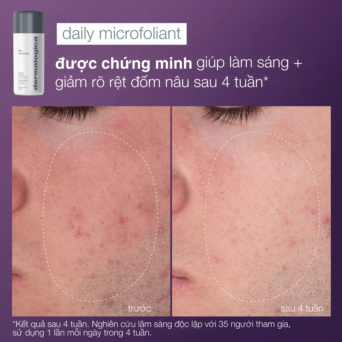Tinh hoa chăm sóc da tối ưu (6 full-sizes + 3 dụng cụ chuyên nghiệp)