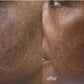 Dermalogica Vietnam 45 phút melanopro peel system treatment
