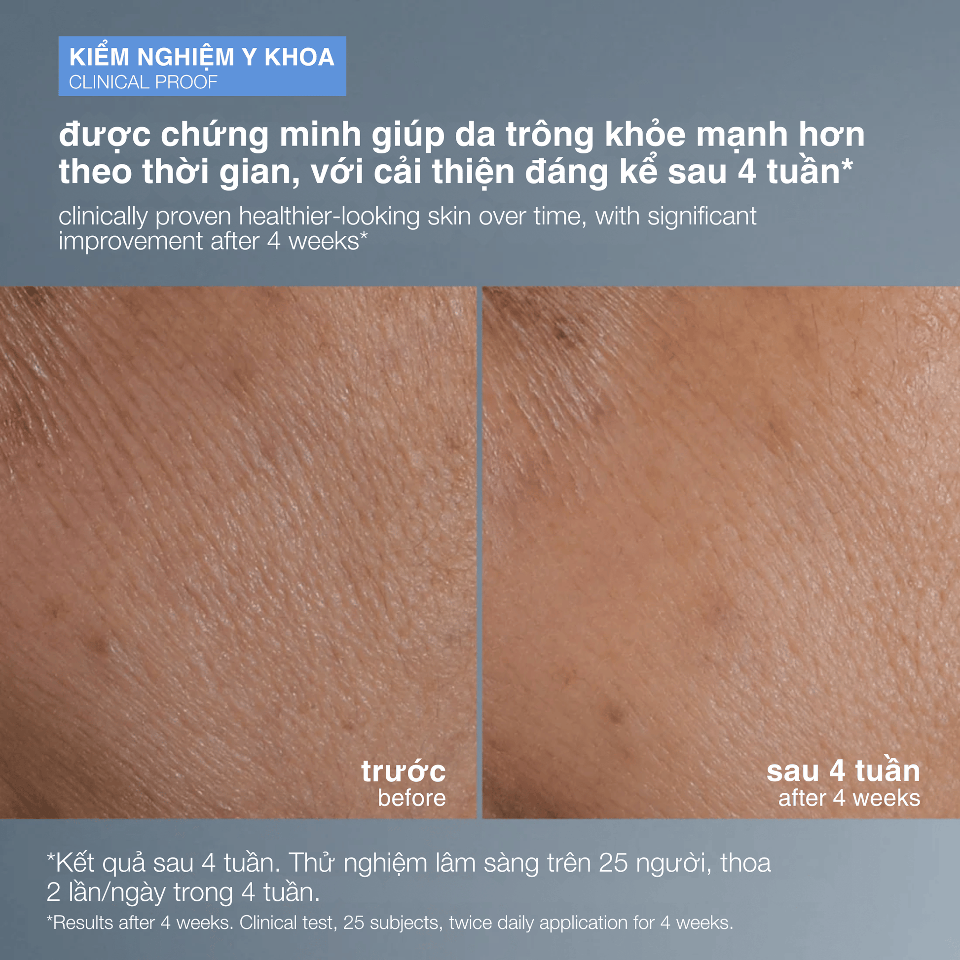 Dermalogica Vietnam FACIAL OILS AND SERUMS tinh chất 4 trong 1 smart response serum