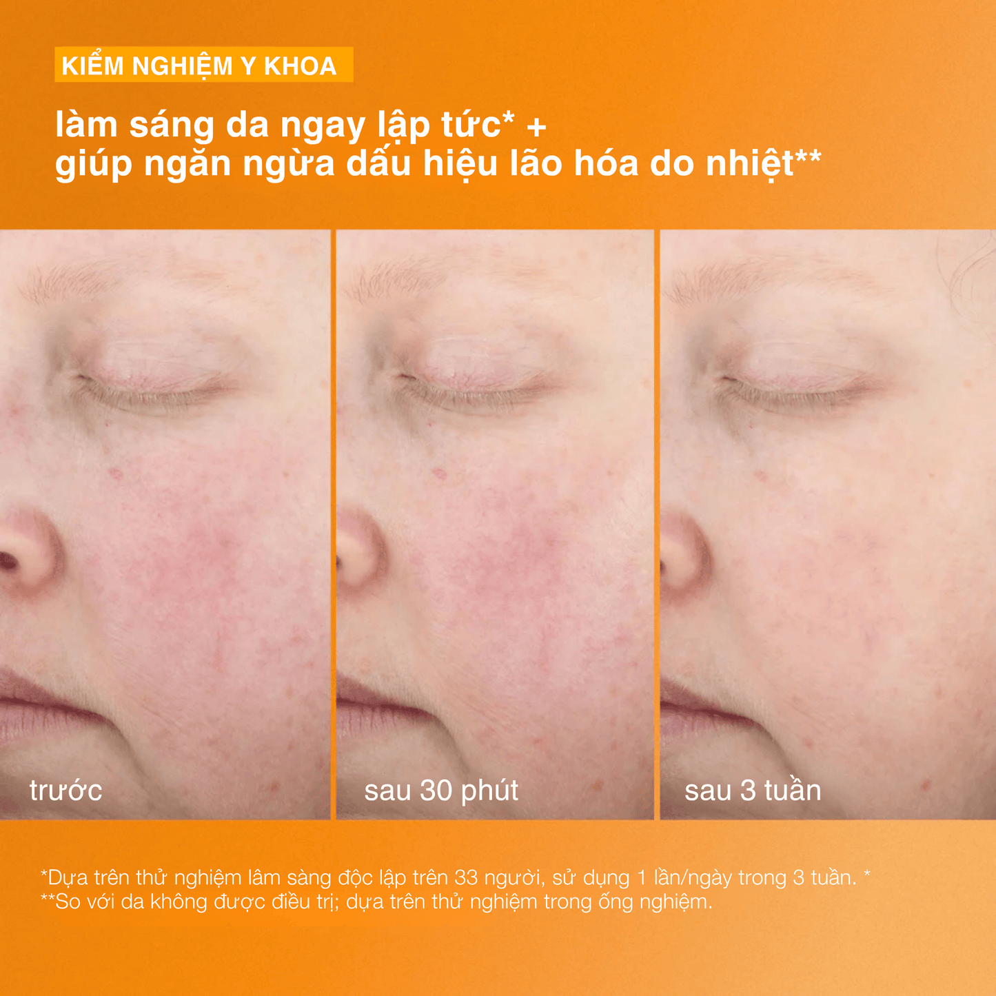 Dermalogica Vietnam SPF kem chống nắng biolumin-c heat aging protector spf50 (Đặt hàng trước ... giao hàng từ ngày 24.07.2026)