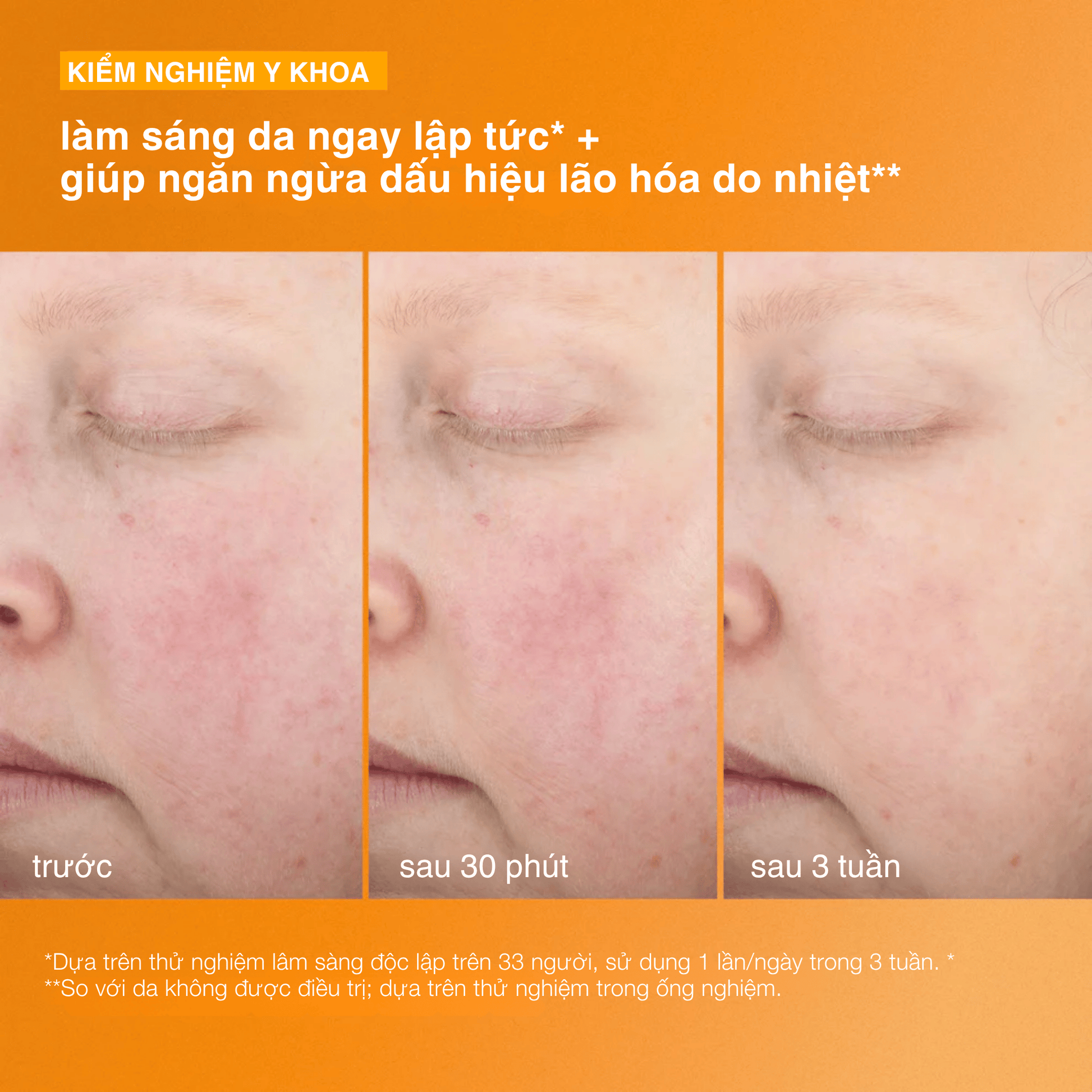 Dermalogica Vietnam SPF kem chống nắng biolumin-c heat aging protector spf50 (Đặt hàng trước ... giao hàng từ ngày 24.07.2026)