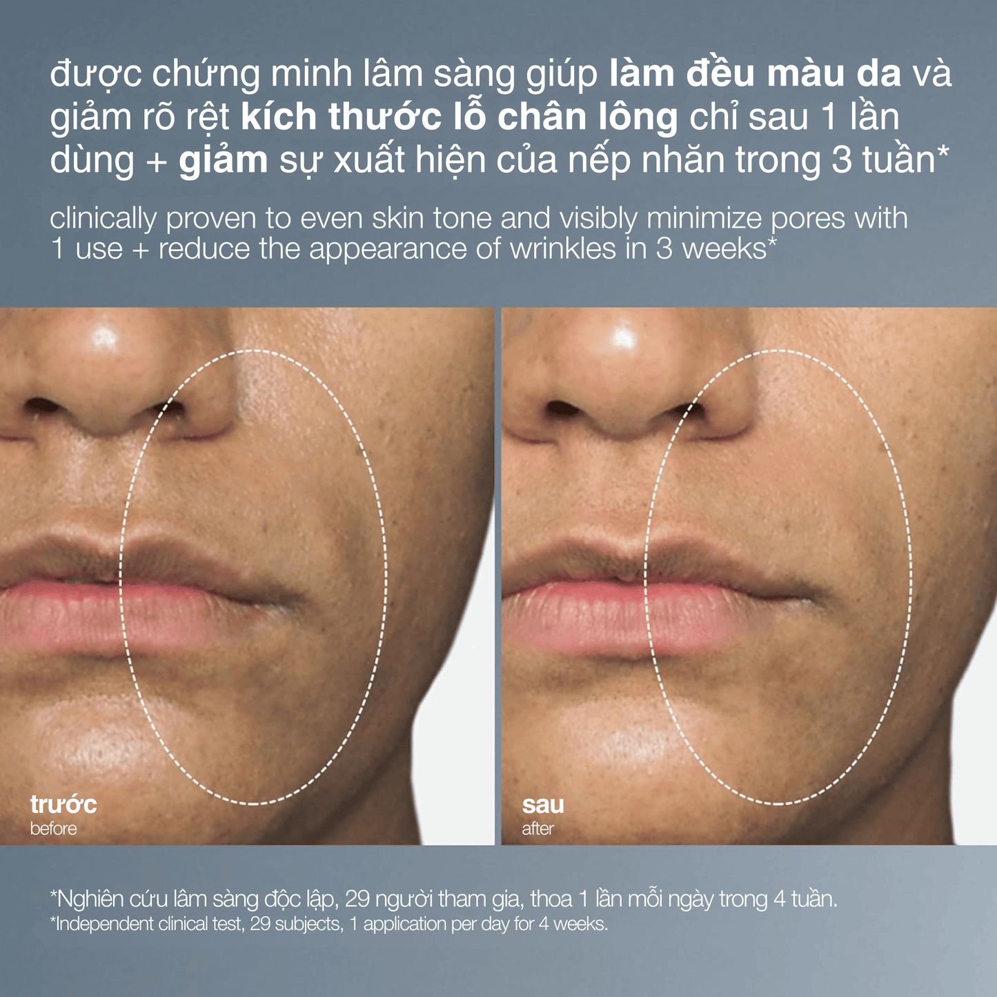 EXFOLIANTS EXFOLIANTS Fullsize 59ml peel da hàng ngày liquid peelfoliant