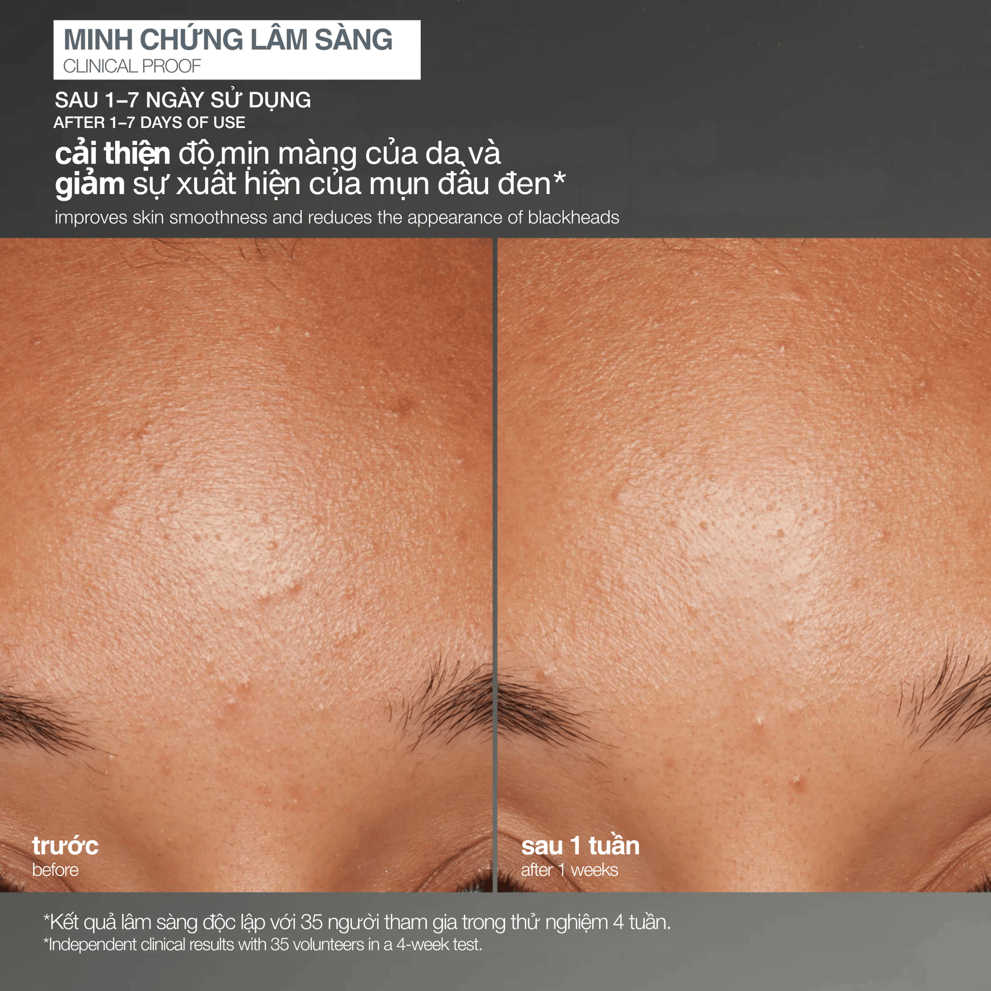 EXFOLIANTS EXFOLIANTS tẩy da chết cám gạo daily microfoliant