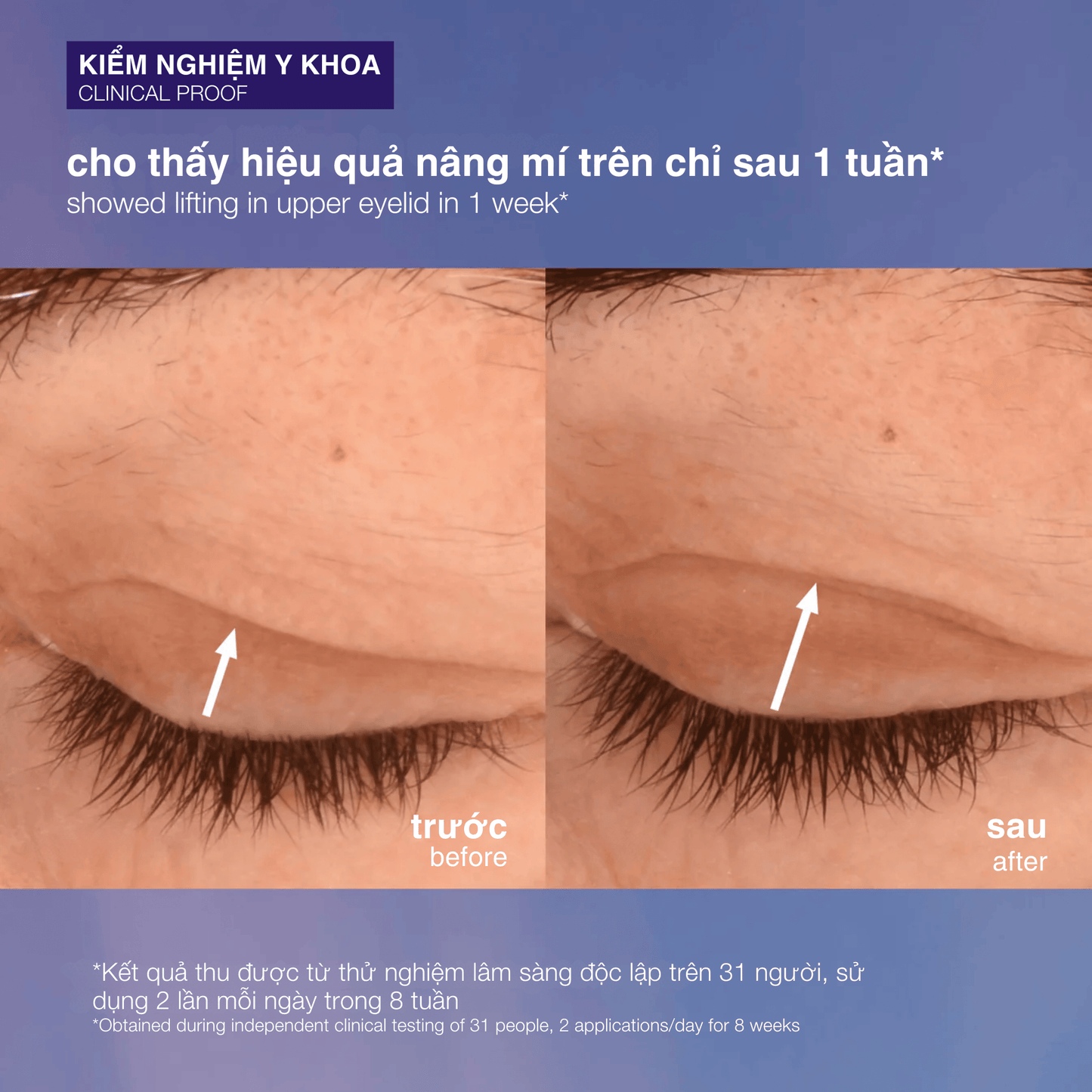 EYE TREATMENTS EYE TREATMENTS 15ml kem mắt săn chắc phyto nature lifting eye cream