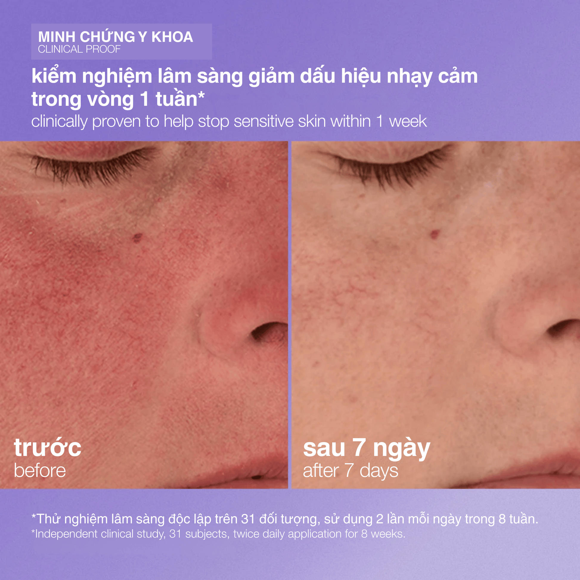 MOISTURIZERS MOISTURIZERS 50ml kem đặc trị da tổn thương stabilizing repair cream