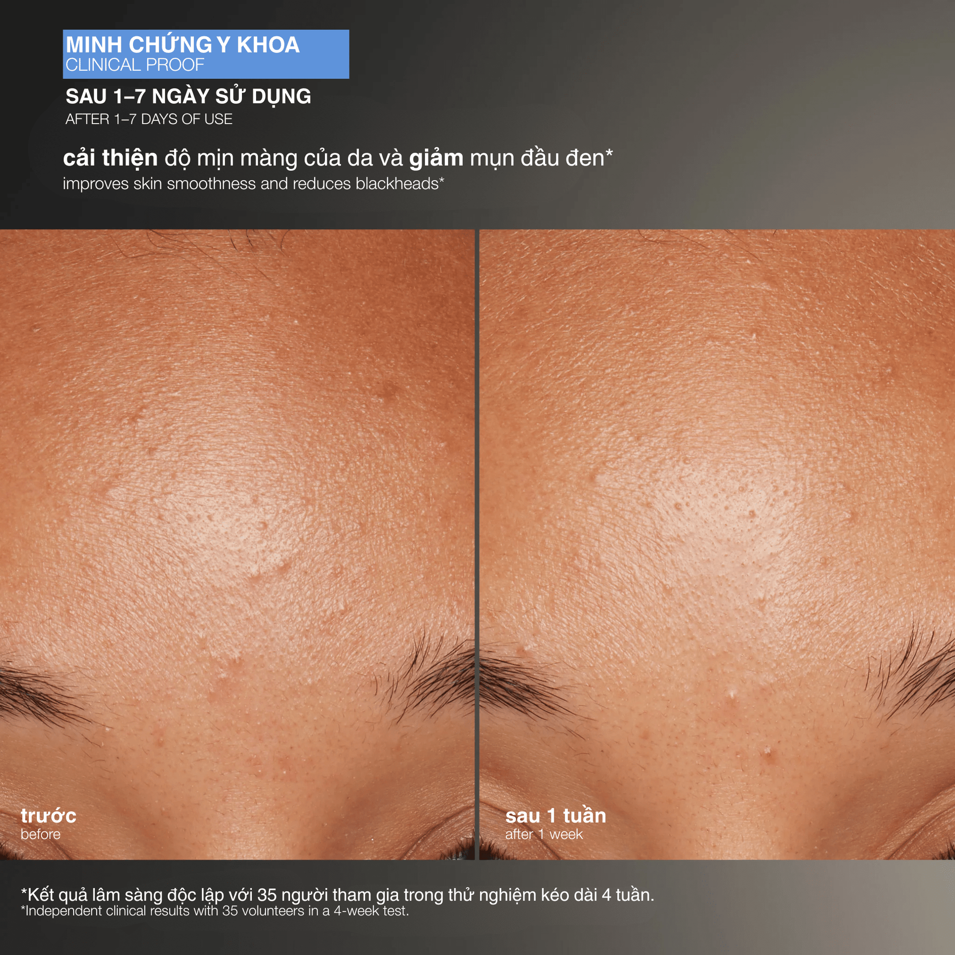 SKIN KITS SKIN KITS bộ đôi Bộ đôi tẩy da chết bán chạy nhất Daily Microfoliant ( 1 fullsize + 1 refill )
