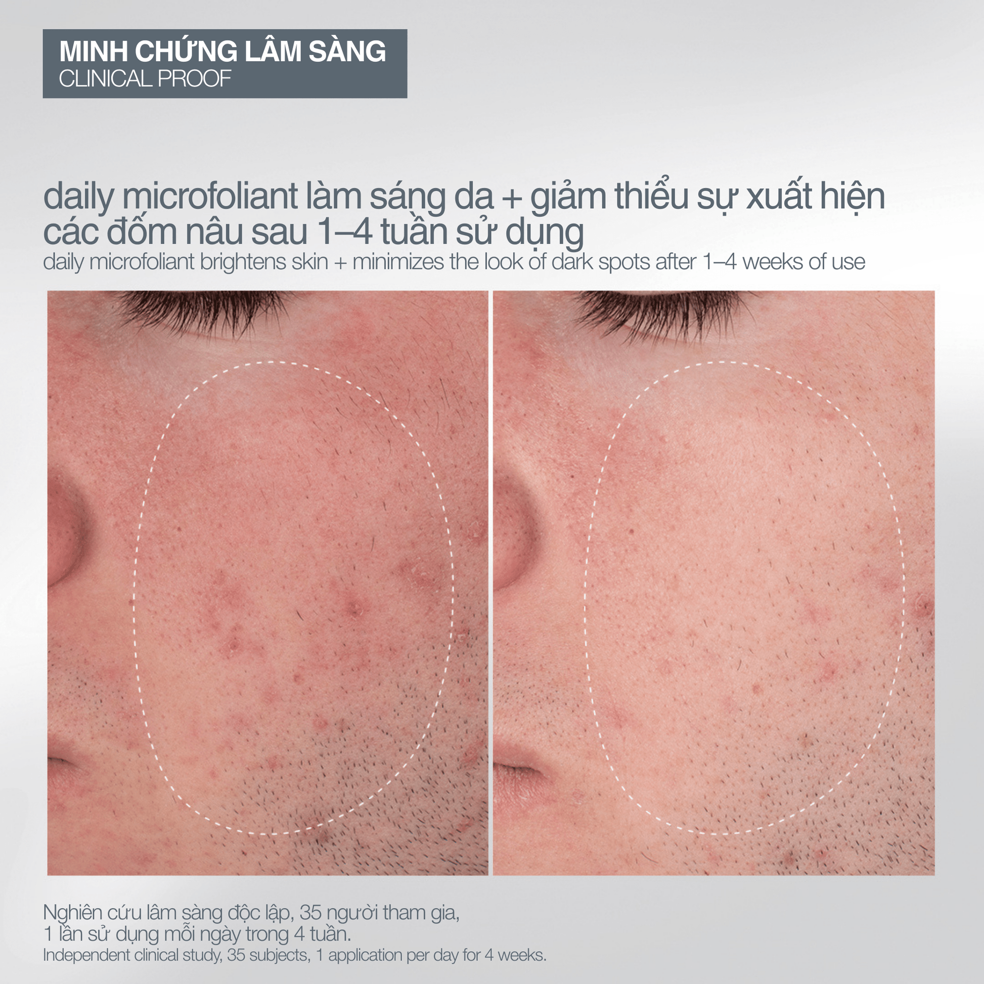 SKIN KITS SKIN KITS bộ sản phẩm Bộ mùa lễ hội 2025 niềm vui nhỏ bé