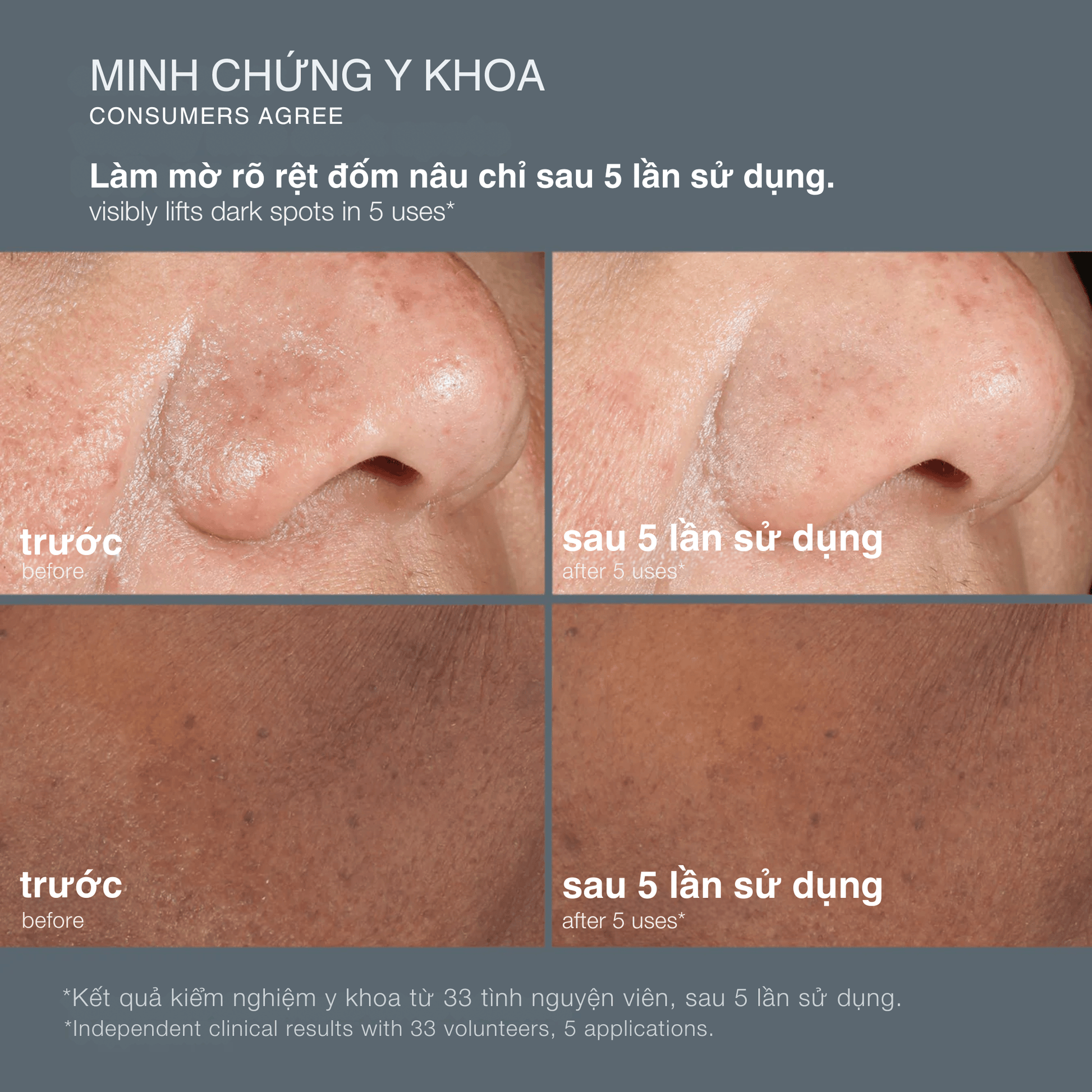 TARGETED TREATMENTS TARGETED TREATMENTS peel da giảm thâm nám powerbright dark spot peel