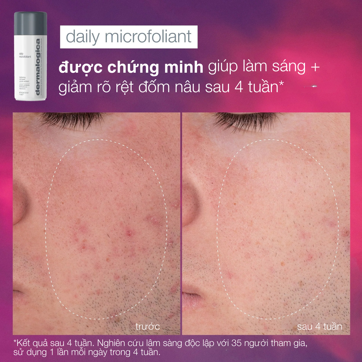 Tái sinh làn da cơ thể (2 full-sizes)